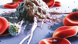 Ung thư máu có khỏi hoàn toàn?