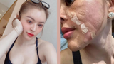 Khoe lột da mặt, hot girl Trang Nemo khiến netizen “chạy mất dép“