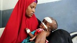 Những hình ảnh nhói lòng về nạn đói ở Somalia