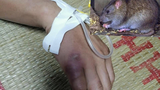 Tưởng vô hại, dịch hạch do bị chuột cắn nguy hiểm thế nào?