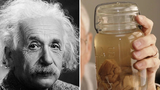 Bác sĩ “điên rồ” nào cả gan đánh cắp bộ não của thiên tài Einstein? 