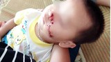 Thực hư việc bé trai 2 tuổi bị bố say rượu chém vào mặt