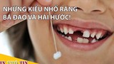 Video: Muôn kiểu nhổ răng bá đạo cho trẻ nhỏ