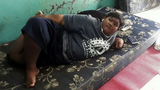 Cậu bé béo nhất thế giới nặng gần 2 tạ "đổi đời" vì giảm cân