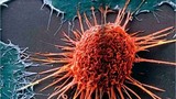 2 gen quyết định khả năng sống sót khi mắc ung thư