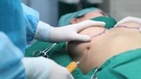 Người phụ nữ nhập viện cấp cứu vì hút mỡ bụng tại thẩm mỹ viện 