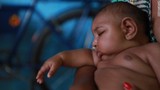 Chùm ảnh châu Mỹ gồng mình chống virus Zika ăn não 