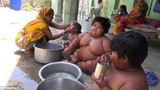 Ấn Độ: Bố bán thận lấy tiền cho con giảm cân