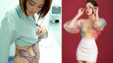 Hotgirl Trâm Anh khoe eo thon sau khi hút mỡ bụng 3 tháng