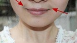 Bắt bệnh “vùng kín” qua các dấu hiệu dễ thấy trên khuôn mặt
