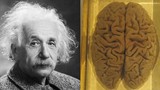 Bộ não của thiên tài Einstein được "mổ xẻ" thế nào? 