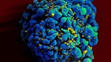 Phát hiện người thứ hai tự khỏi HIV