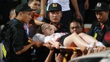 Trúng pháo sáng CĐV Nam Định trên SVĐ Hàng Đẫy, fan nữ phải nhập viện