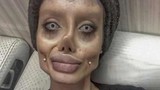 "Cô gái xác sống" phẫu thuật giống minh tinh Angelina Jolie bị bắt