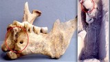 Hộp sọ chiến binh thế kỷ 14 được tìm thấy với sợi chỉ vàng