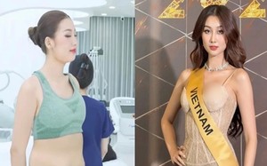 Quế Anh nói gì khi bị cắt ghép ảnh đi hút mỡ bụng?
