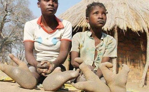 Vì sao bộ lạc Doma ở châu Phi lại có "bàn chân đà điểu"?
