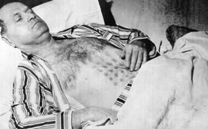 Chạm trán UFO, người đàn ông bị bỏng nặng, 32 năm không mờ vết