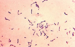 Vi khuẩn gây bệnh bạch hầu nguy hiểm sao?