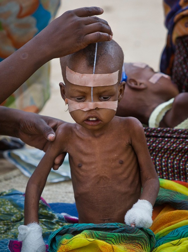 Động lòng hình ảnh trẻ đói ở Châu Phi | Tin tức | TriThucCuocSong.vn