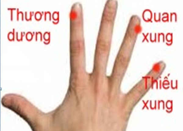 xuất huyết não