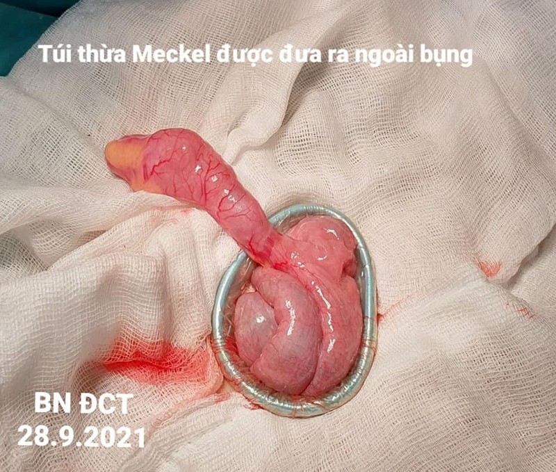 tui-thua.jpg