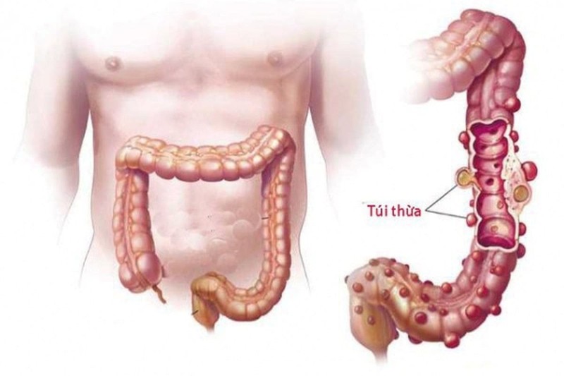 tui-thua.jpg