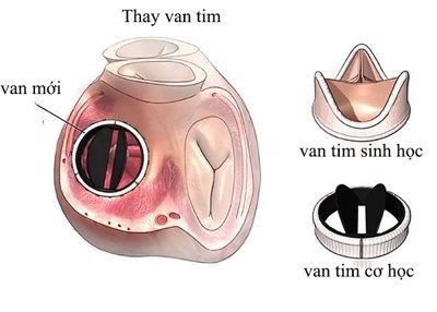 van-co-hoc.jpg