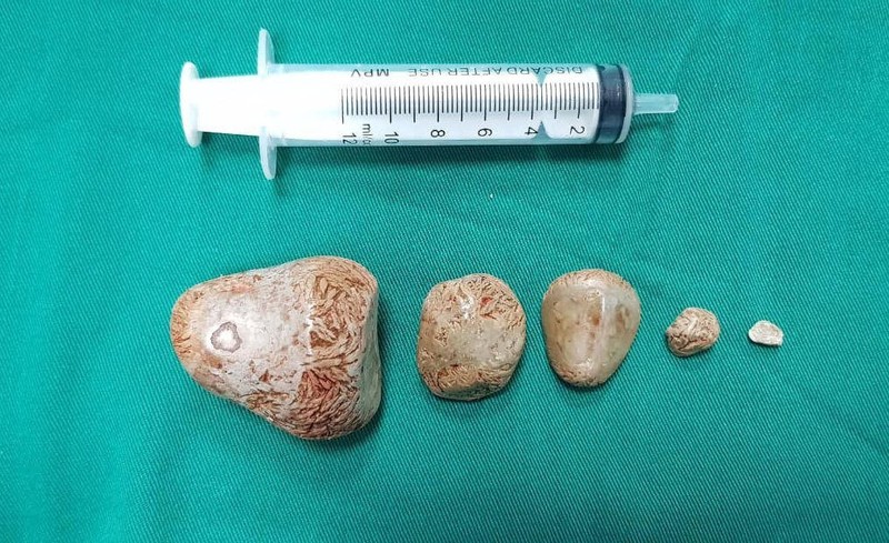 vien-soi.jpg