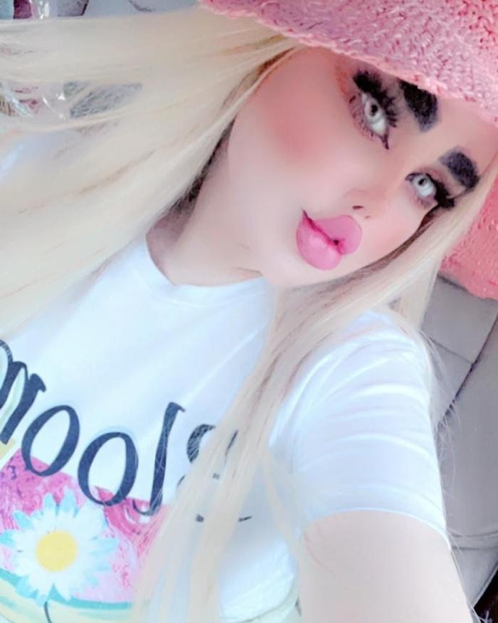 Phau thuat 43 lan vi muon giong bup be Barbie va ket dang-Hinh-3