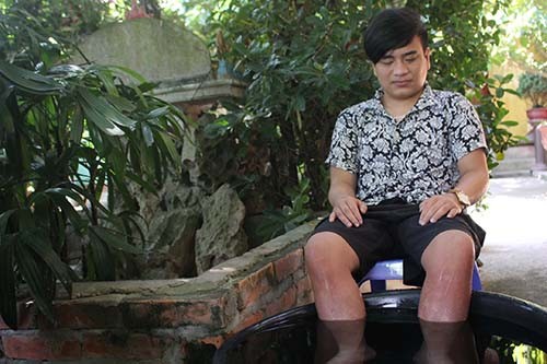 Chang trai 19 nam co doi chan nong nhu than gio ra sao?-Hinh-2