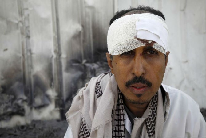 Yemen tan hoang sau cac cuoc khong kich cua lien quan A-rap-Hinh-3