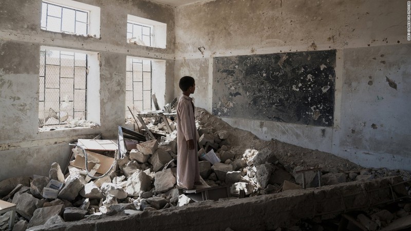 Toan canh cuoc khung hoang nhan dao tram trong o Yemen-Hinh-11