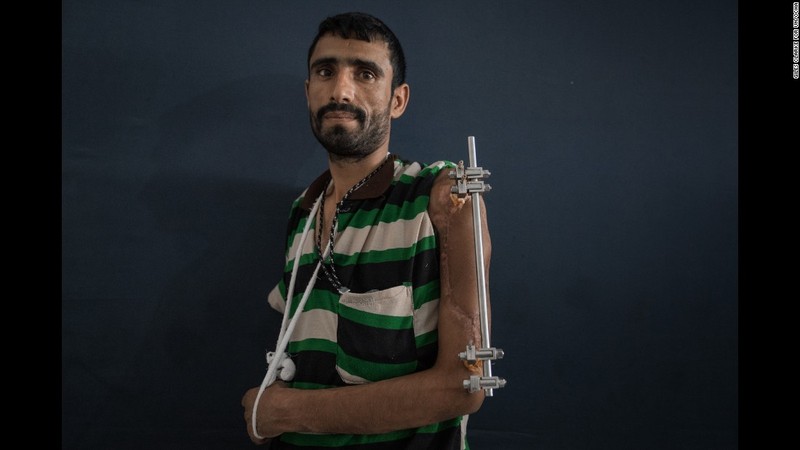 Toan canh cuoc khung hoang nhan dao tram trong o Yemen-Hinh-8