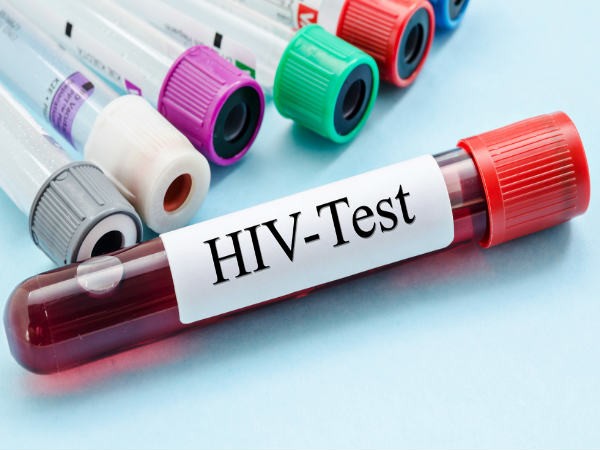 Virus giong HIV, nguy co lay sang nguoi nguy hiem sao?
