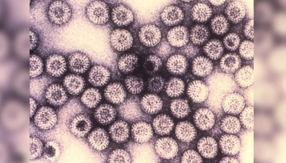 10 loai virus “chet choc” nhat lich su-Hinh-13