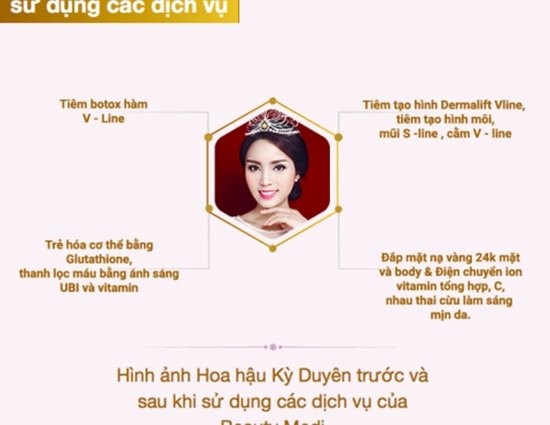 Hanh trinh “bien doi” cam vuong thanh cam nhon cua Ky Duyen-Hinh-5