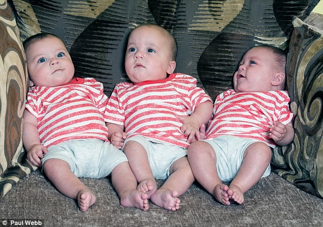 Lạ lùng ca sinh ba có 2 bé chung nhau thai và bọc ói-Hinh-5