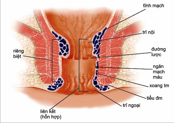 Nhung nguoi khong duoc uong nuoc gung giam can-Hinh-6