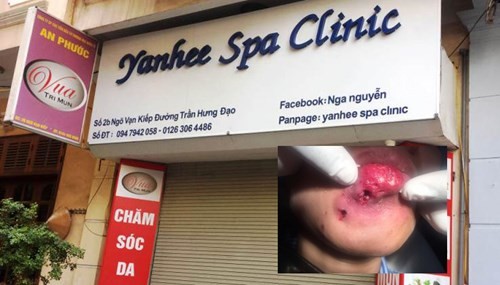 Con sot tay chay Yanhee Spa Clinic nghi lam khach hoai tu moi