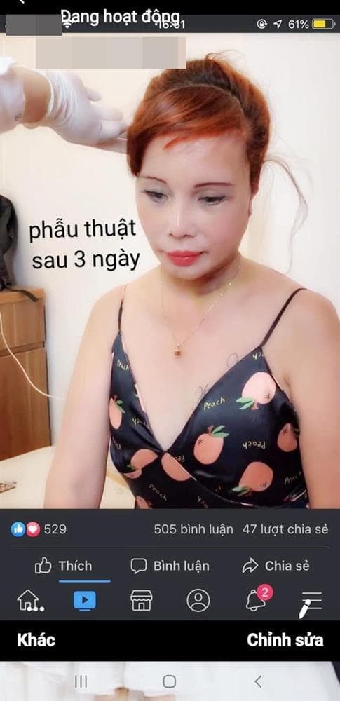 Chua dung phau thuat tham my, co dau 62 tuoi 