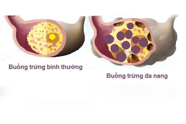 Loi ich bat ngo tu thuoc ngua thai cho phu nu-Hinh-5