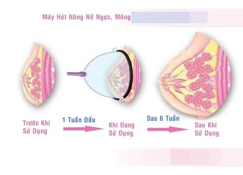 “Tien mat tat mang” voi nhung kieu lam dep sot xinh xich tren mang-Hinh-5