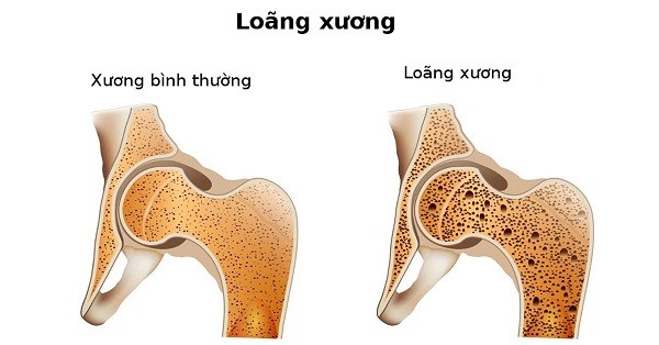 Mua xuan la “thoi diem vang” hap thu canxi, dung cach nay dai loi-Hinh-2