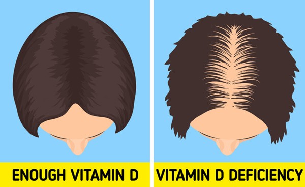 Giat minh loat dau hieu “to cao” co the thieu vitamin D tram trong-Hinh-3