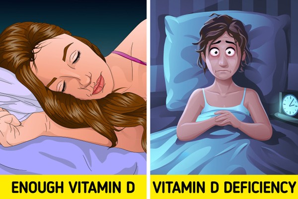 Giat minh loat dau hieu “to cao” co the thieu vitamin D tram trong-Hinh-4