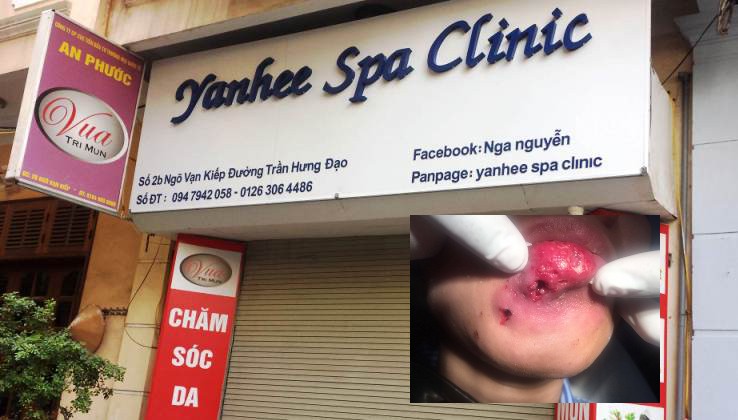 Co gai bi hoai tu moi vi lam dep o Yanhee Spa Clinic?-Hinh-2