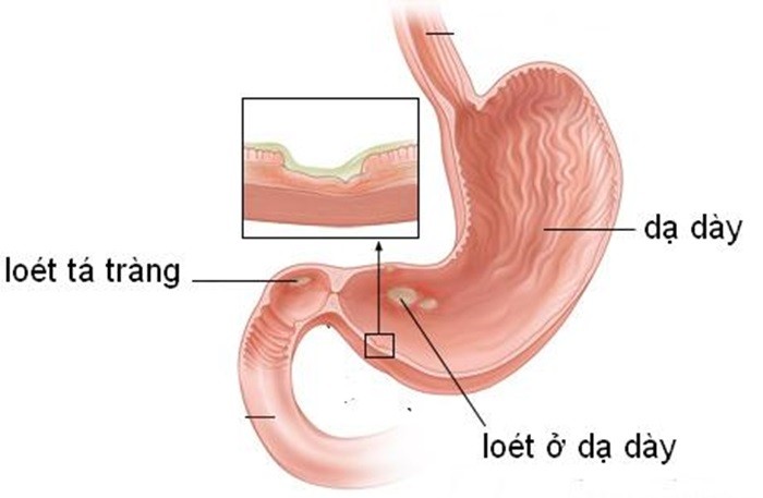 Cong dung chua benh tuyet voi cua cac loai dau-Hinh-6