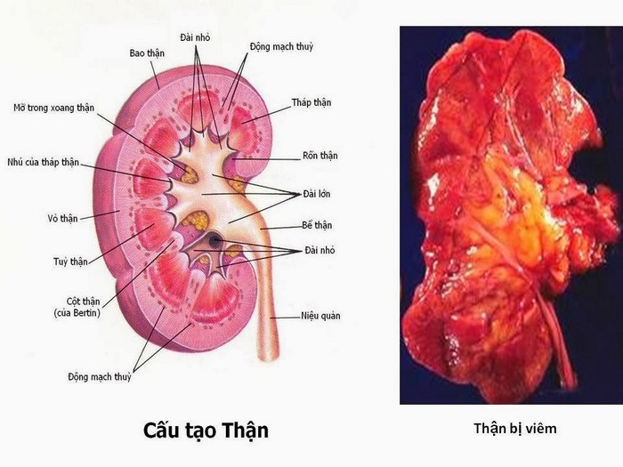 Cac bai thuoc chua benh ky dieu tu thuc pham co vi cay-Hinh-10