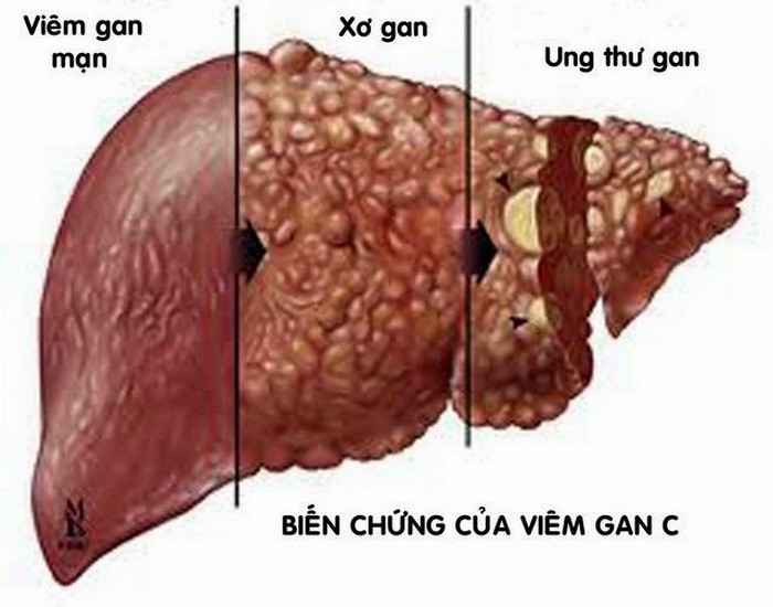 Bai thuoc hay chua benh hieu qua tu cac loai tam gui-Hinh-5